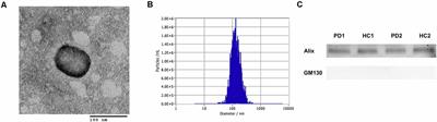 Decreased Exosomal Acetylcholinesterase Activity in the Plasma of Patients With Parkinson’s Disease